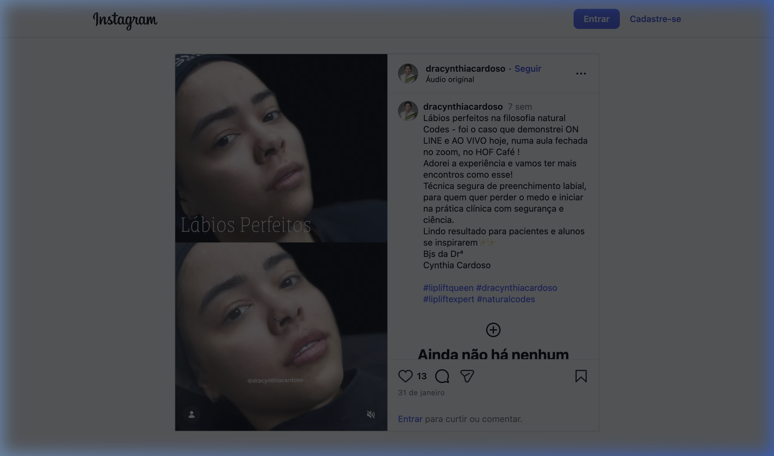 Lábios Perfect Codes