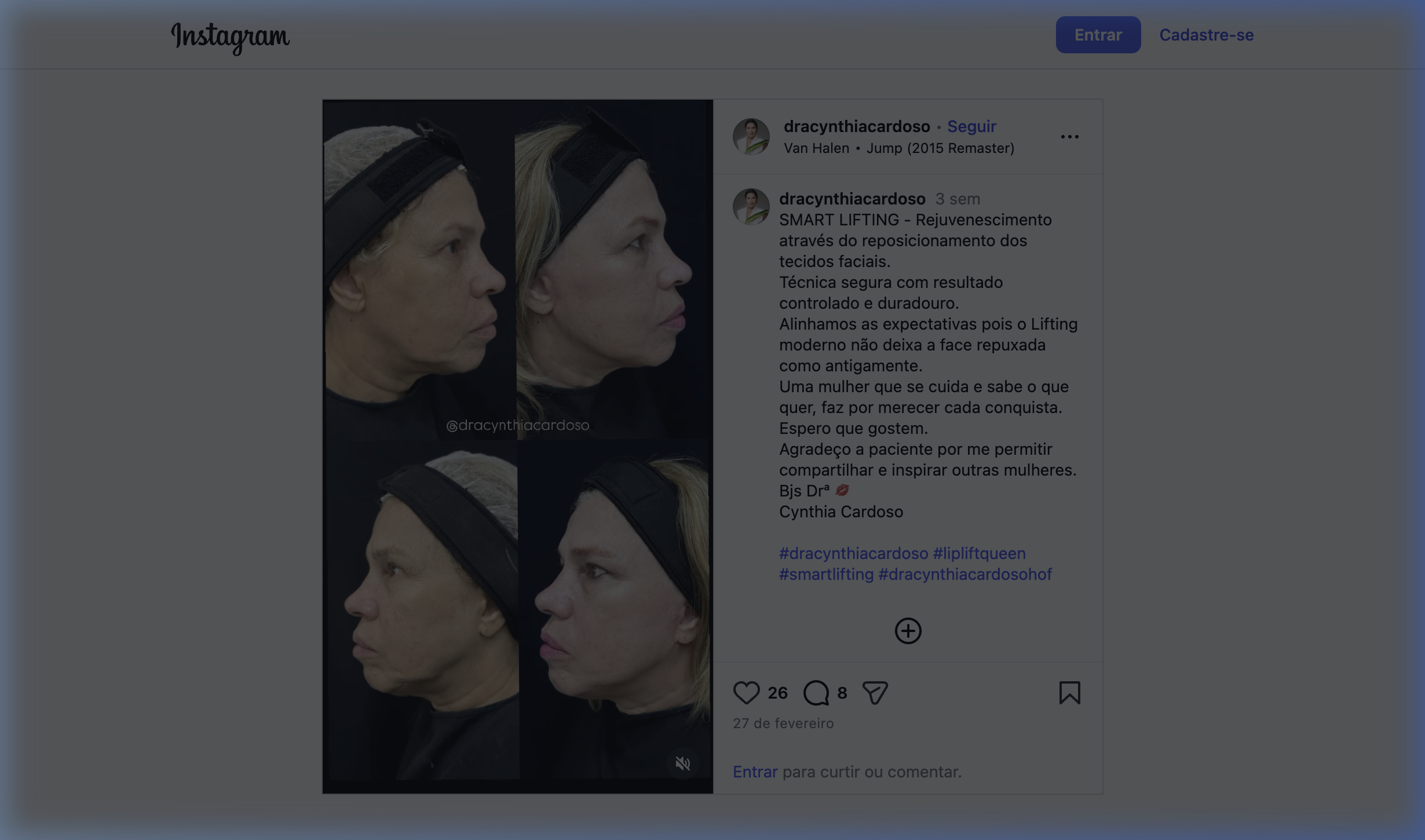Smart Lifting Facial